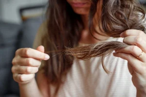 hair loss treatment london
